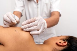 dry needling schouderklachten