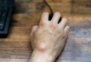 ganglion behandeling