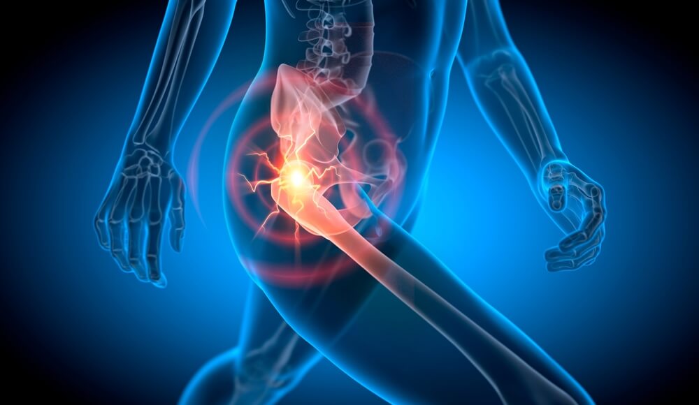 shockwave therapie heup