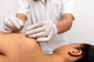 dry needling schouderklachten